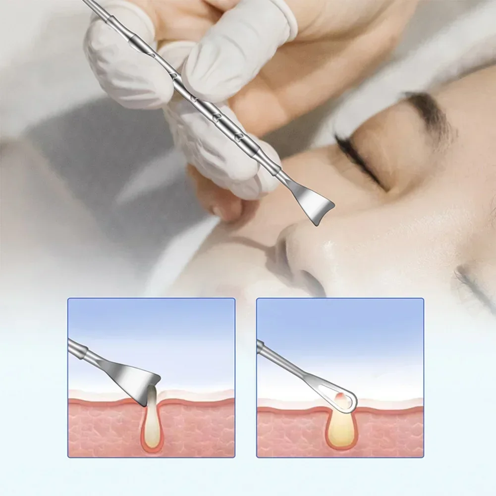 Blackhead Remover Pimple Popper Tool Acne Needle Removing Treatment Comedone Whitehead Popping Zit Nose Face Blemish Extractor