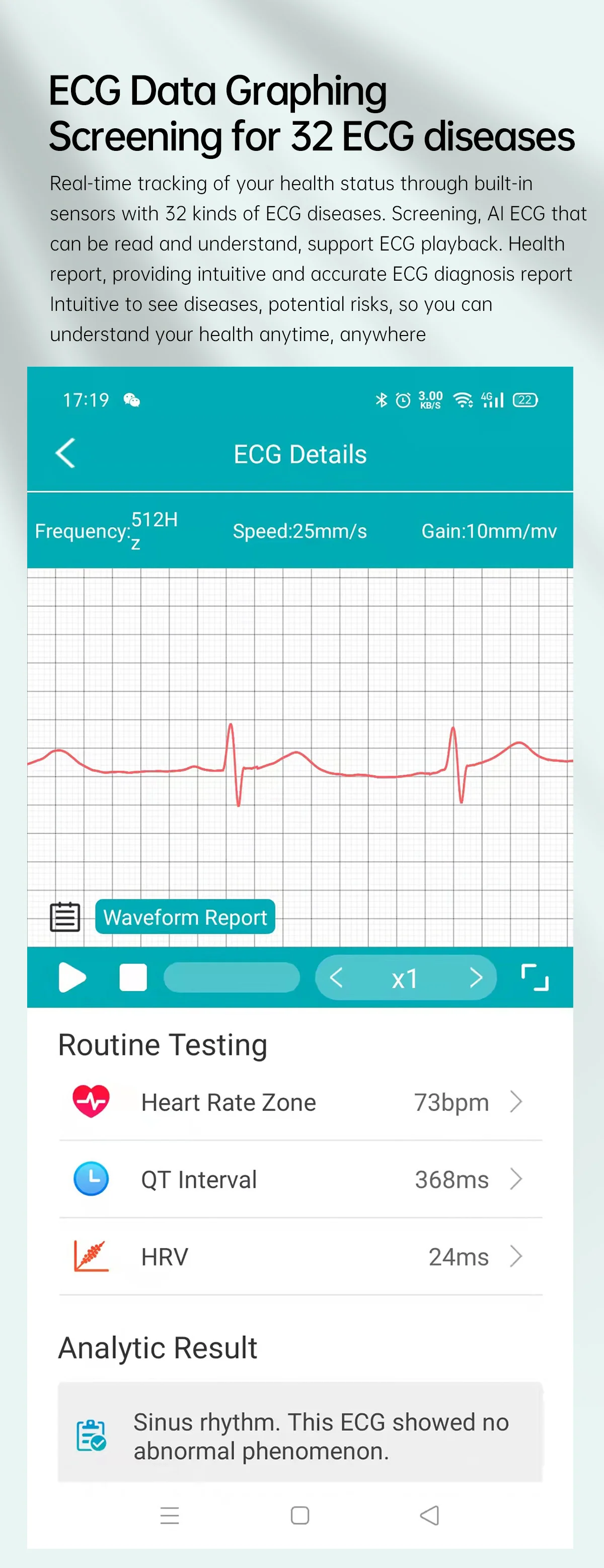 Xiaomi sports smartwatch with Blood Glucose, Blood Pressure/Sugar, Body Temperature, Heart Rate