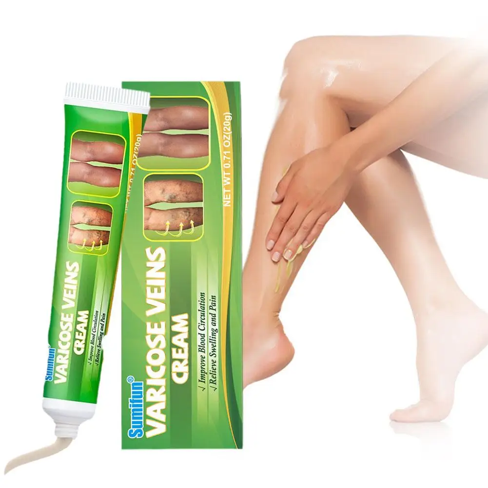Varicose Veins Treatment Cream Relieve Legs Dilated Vasculitis Phlebitis Natural Formula Ointment varicose vein ointment