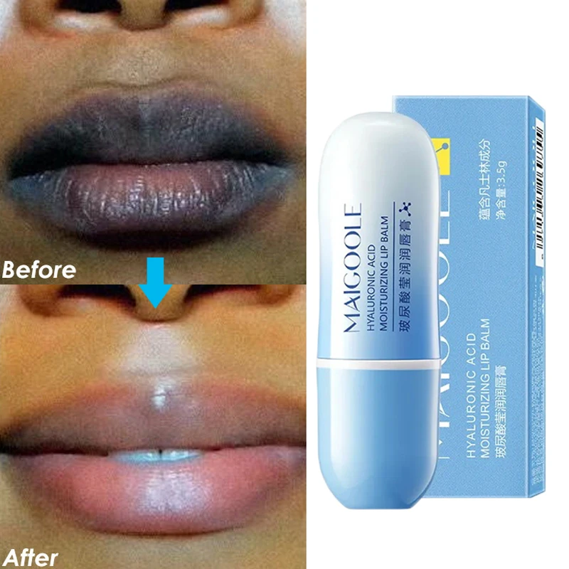 

Hyaluronic Acid Lip Balm Remove Dark Lips Whitening Moisturizing Cream Exfoliating Dead Skin Lightening Pigment Beauty Lip Care