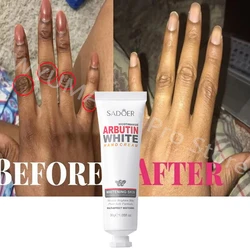 Niacinamide Whitening Hand Cream Moisturizing Anti-Dry Crack Wrinkle Products Pigmentation Correctors Smooth Nourish Skin Care