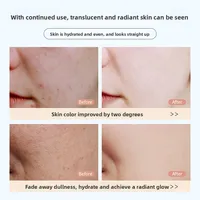 RUYI Niacinamide Face Mask Hydrating Moisturizing Whitening Improves Dullness Anti-Dryness Skin Nourishment​ Winter skincare​ 2