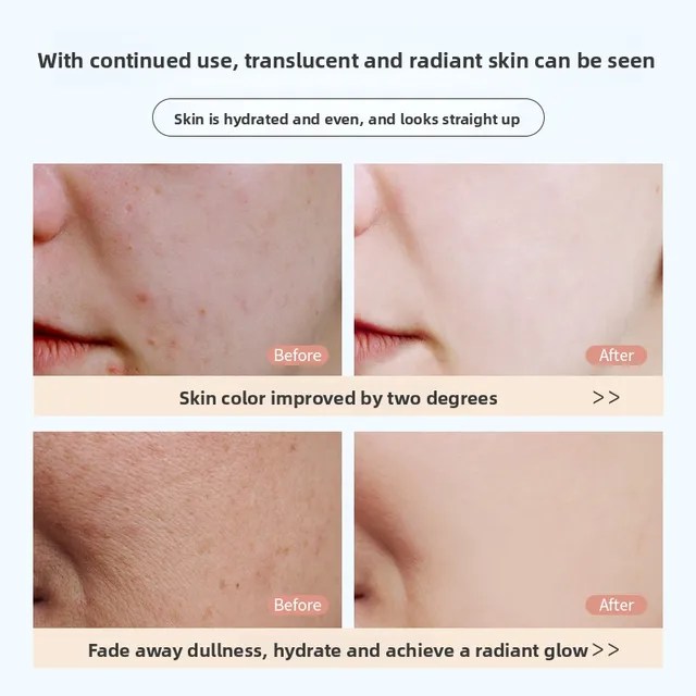 RUYI Niacinamide Face Mask Hydrating Moisturizing Whitening Improves Dullness Anti-Dryness Skin Nourishment​ Winter skincare​ 2