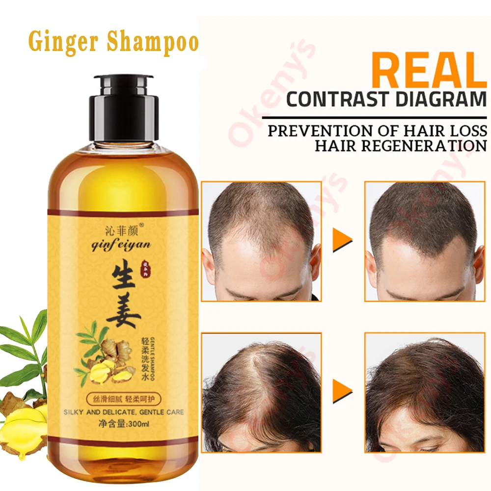 Genuine Professional Hair Ginger Shampoo 300ml, Hair Regrowth Dense Fast, Thicker, Hair Growth