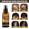 46218-811808.jpg Biotin Fast Hair Growth Spray Anti Hair Loss Serum Prevent Baldness Treatment Scalp Beard Beauty Essence Hair Care Products 30ml