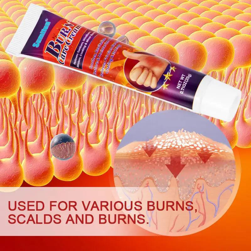 First Aid Burn Care Cream Relieves Sunburn Windburn Blisters Cooking Minor Burns Skin Care