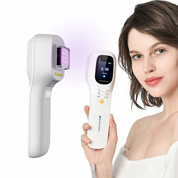 

Handheld 308nm LED UVB Phototherapy no excimer Home Phototherapy UV Therapy Light Psoriasis Vitiligo Treatment