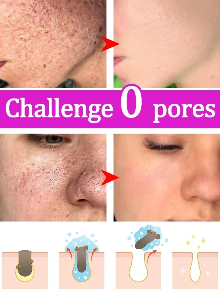 Pore remover contraction cleaning tool 5