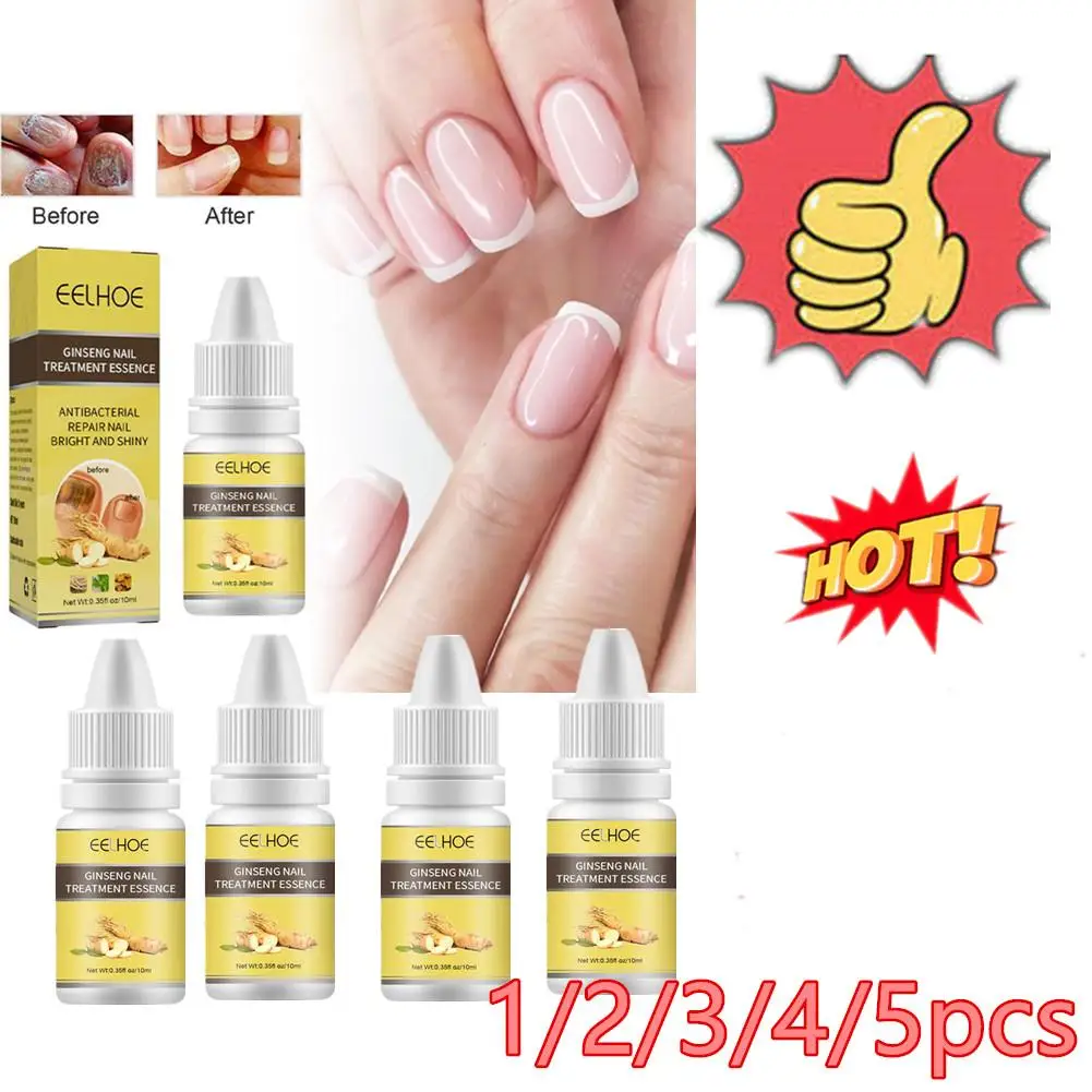 

Lot 10ml Nail Fungus Removal Cream Onychomycosis Fungal Nail Fungal Nail Ointment Anti Infection Toe Feet Paronychia Treatment