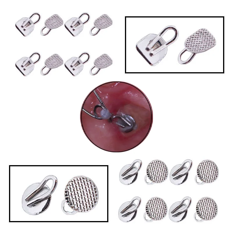 

Dental Orthodontic Traction Hook Lingual Button Round Rect Base Stainless Steel Dentistry Odontologia Dental Odontología