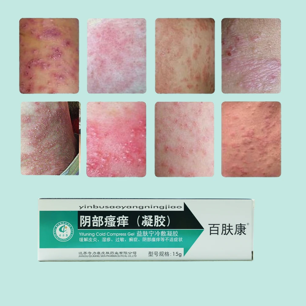 Vulvar Dermatitis Symptoms Outlet Cheap clc.cet.edu