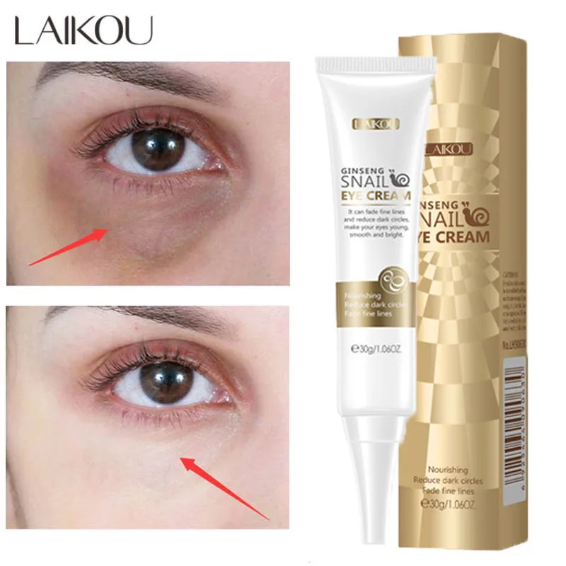 Snail Remove Dark Circles Eye Cream Niacinamide Whitening Moisturizing