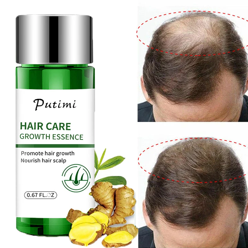 Crescimento Do Cabelo leos Essenciais Ess ncia Produtos De Tratamento 
