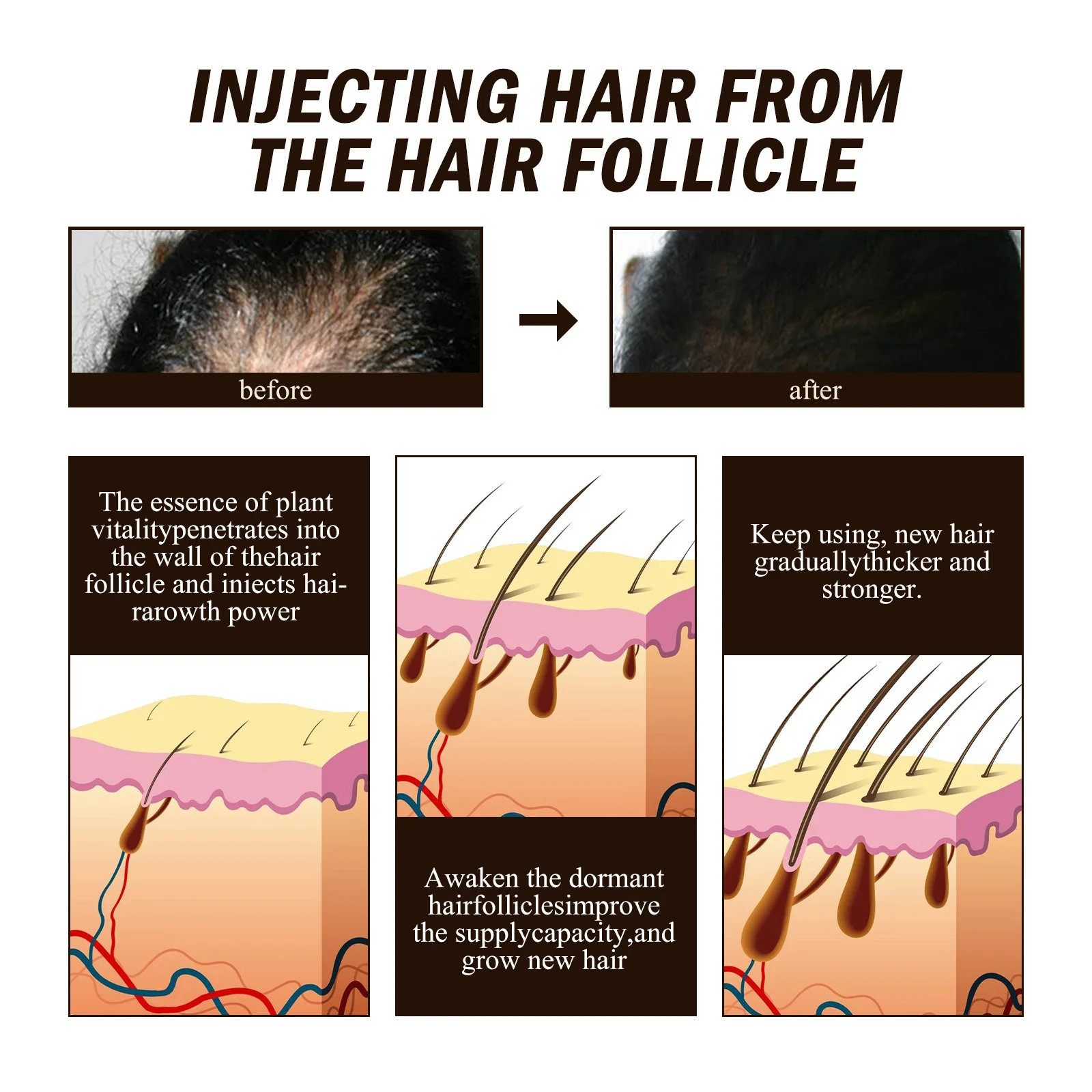 Description Picture 4 of itemPowerful Hair Growth Serum Spray Ginger Anti Hair Loss Treatment Products Repair Nourish Hair Roots Fast Regrowth Hair Men Women