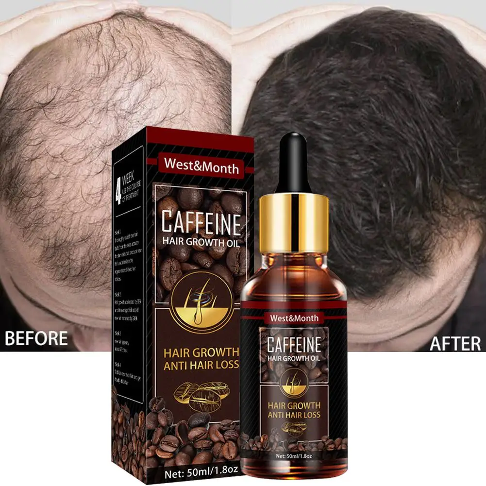 Caffeine Hair Growth Essential Oil Hair Loss Preventation Nourishing Hair  Roots Hair Repair Treatment Oil Promote Hair Growth - AliExpress