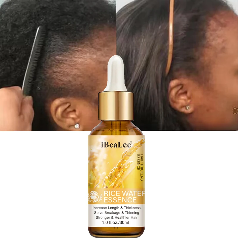 

Fast Hair Growth Serum Anti Hair Loss Essence Oil Prevent Baldness Stronger Hair Roots Repairs Damage Nourishing Softening Care