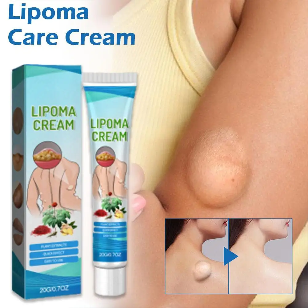 

Herbal Lipoma Removal Cream - Effective Lipoma And Fibroids Removal Ointment - Dissolves Fat Body Cream For Lipoma Removal