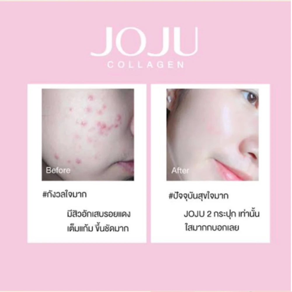 3X JOJU Collagen Dipeptide Reduce Acne Dark Spots Freckles oil control Smooth Lightening Whiten and brighten Younger Skin Care
