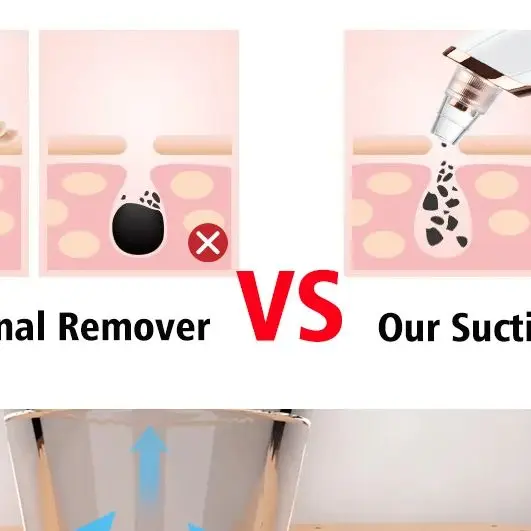ABS Electric Blackhead Remover Vacuum Cleaner for Facial Deep Cleansing