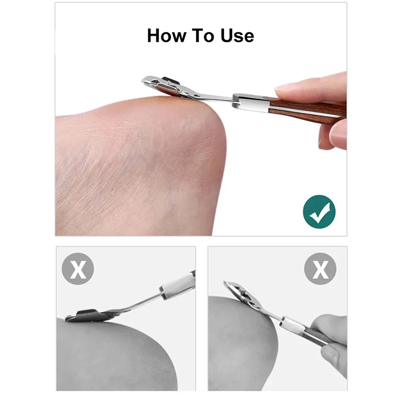 https://ae01.alicdn.com/kf/S854171dd79024ac2a3da7d650f80e2deH/Foot-Callus-Remover-Shaver-Heel-Hard-Dead-Skin-Remover-Scraper-Cuticle-Cutter-Razor-Feet-Pedicure-Tools.jpg