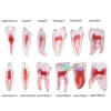 Dental RCT Endo Training Teeth Model 3D Curved Root Resin 12 Size 1:1 Endodontic Education Cavity 1