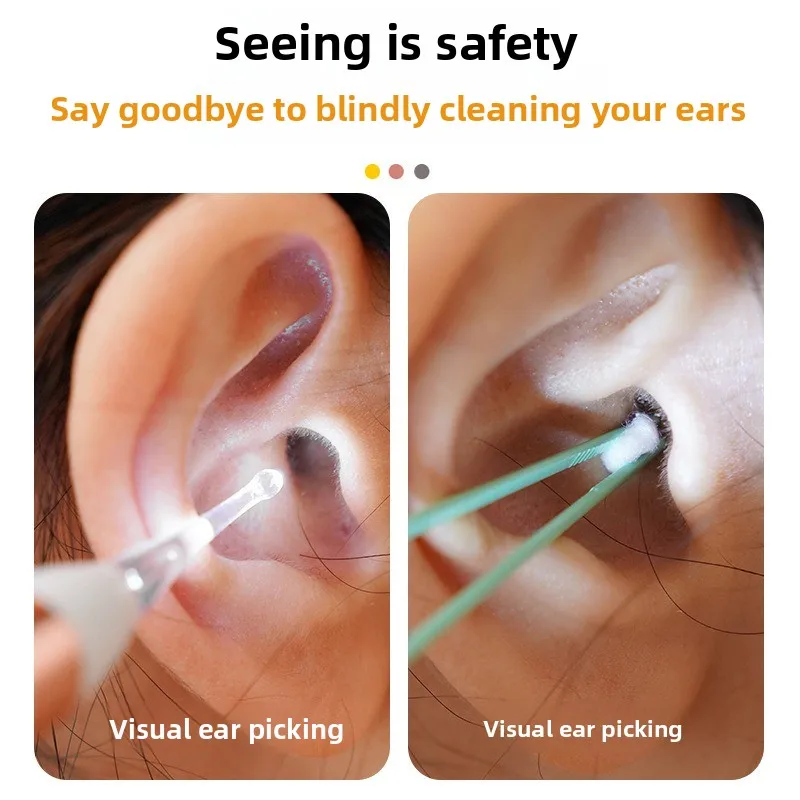 LED Light Ear Cleaning Kit 2 in 1 Tweezers Curette Spoon Clip Otoscope for Safe Earwax Removal  Ear Cleaning