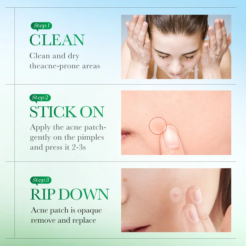 SADOER Invisible Acne Patches Removal Pimple Anti-Acne Hydrocolloid Patches Spots Marks Concealer Repair Sticker Waterproof