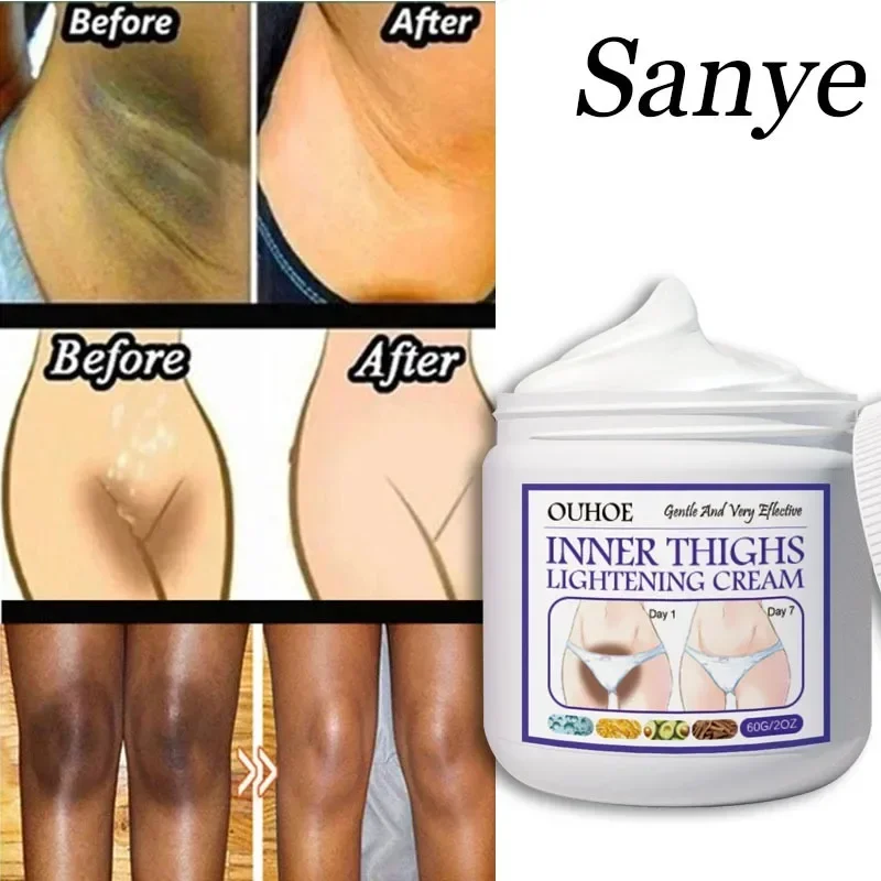 Private Parts Underarm Bleaching Serum Whiten Butt Knee Brighten Inner Thigh Intimate Parts Dark Remover Melanin Whitening Cream