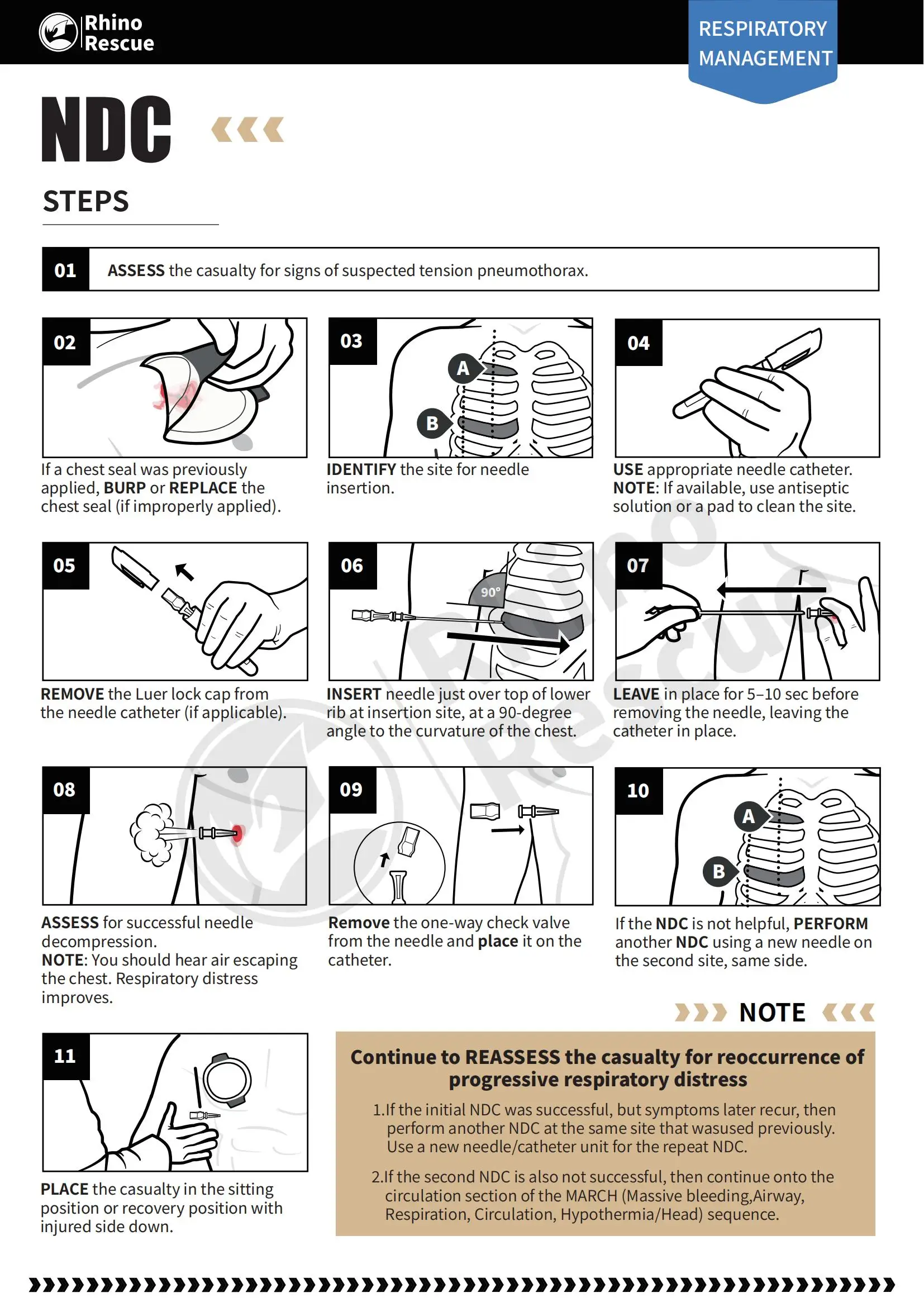 Rhino Rescue Pneumothorax Needle Trauma Medical Ifak Chest Cathether Needlecatheter 50g Needle Decompression