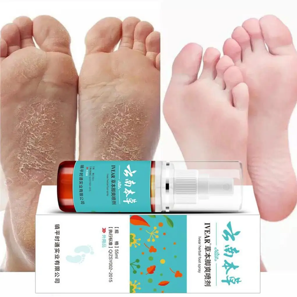 

55ml Athlete s Foot Spray Liquid Smelly Feet Spray Foot Spray for Women and Men