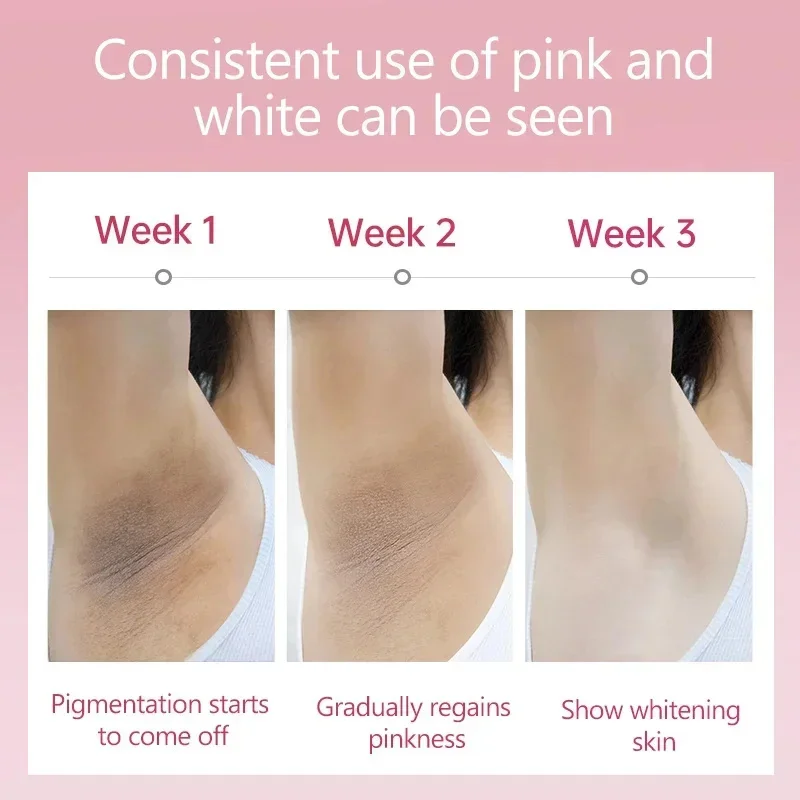 Whitening Cream For Dark Skin Armpit Thigh Inner Joint Lightening Intimate Area Underarm Body Care Private Parts Brighten Lotion 3