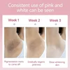 Whitening Cream For Dark Skin Armpit Thigh Inner Joint Lightening Intimate Area Underarm Body Care Private Parts Brighten Lotion 3