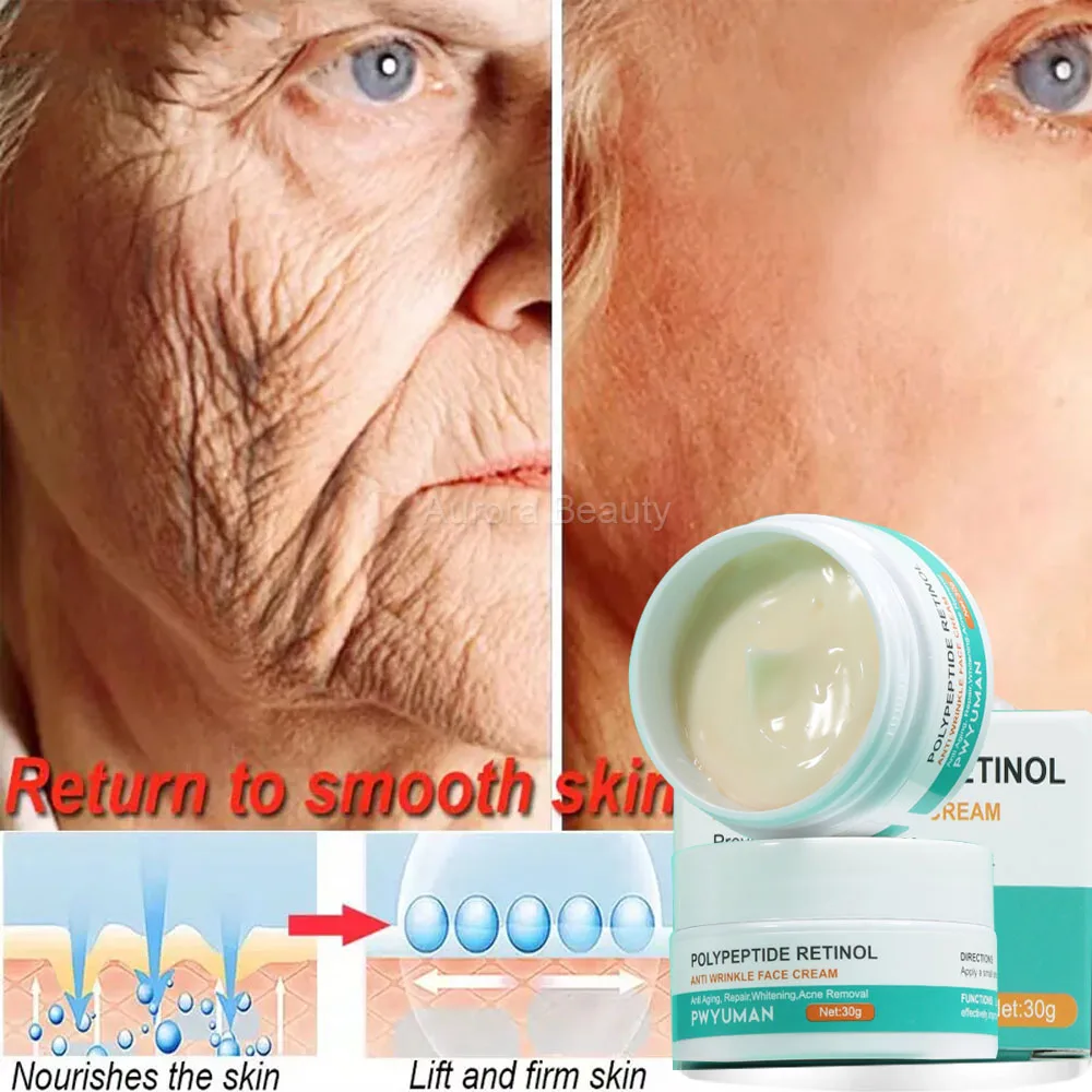 Retinol Remove Wrinkle Face Cream Lifting Firming Fade Fine Line Anti-aging Whitening Moisturizing Korean Skin Care_voghion.com