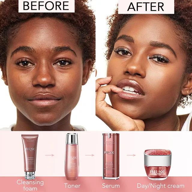 Ailke-Fehérítés És Ragyogó Tónusú Krém, Természetes Alapanyagok, C-Vitaminnal, Sötétség Tisztításával, Foltokkal, Bőr Izzó - Image 5