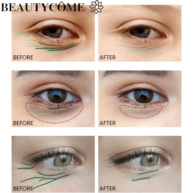 15768-67342a.jpg BEAUTYCOME – crème pour le visage, sérum pour les yeux au rétinol, ensemble de 4 pièces, raffermissant, Anti-âge, réduit les rides, ridules, soins pour la peau