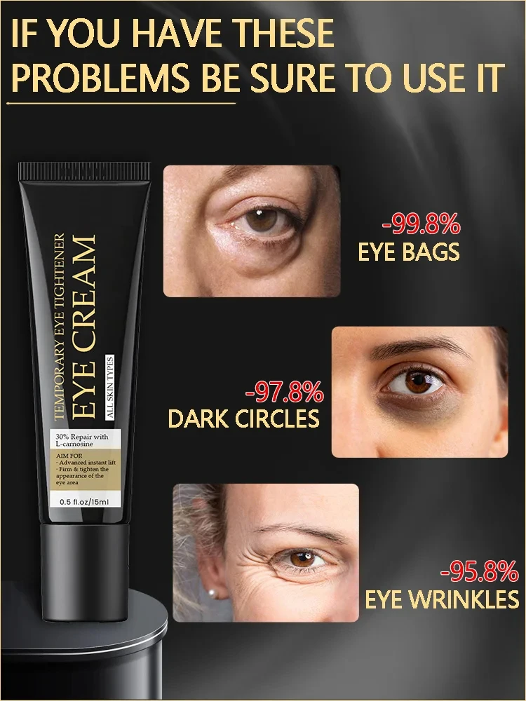Eye cream Under eye bag puffy fat removal