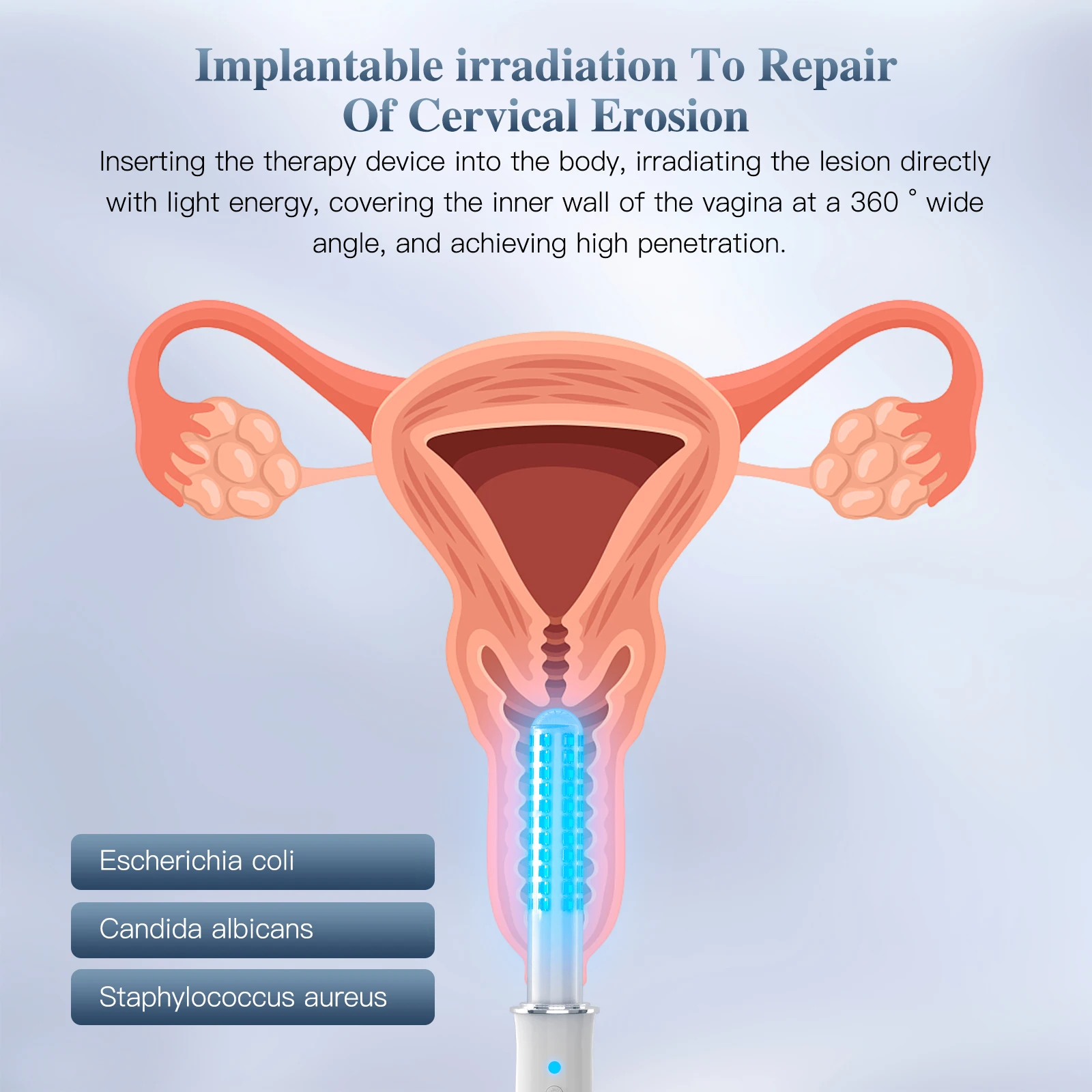 KTS Vaginal Vibrator Wireless Vaginal Massager Red Light Therapy Device for Vaginitis Female Sex Wand Vaginal Tightening Device 2