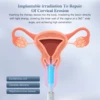 KTS Vaginal Vibrator Wireless Vaginal Massager Red Light Therapy Device for Vaginitis Female Sex Wand Vaginal Tightening Device 2
