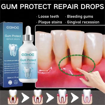 Siero per la cura della riparazione rapida delle gengive danneggiate Allevia l'allergia dei denti Carie dentali Pulizia dei denti Dentifricio Alleviare i danni ai denti Gocce 1