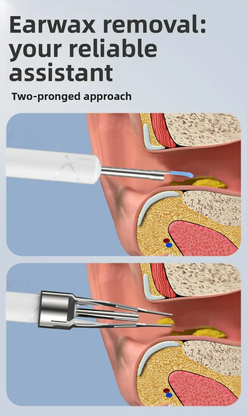 Rechargeable Wireless Ear Wax Removal Tool With 5mp Camera Set_voghion.com