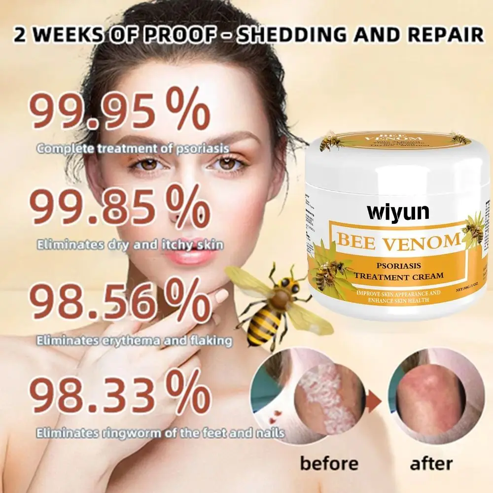 Repair Hands and Feet Skin Moss Bee Venom Psoriasis Cream Smooth Moisturizing Bee Venom Cowhide Moss Cream Red Itchy Skin Care