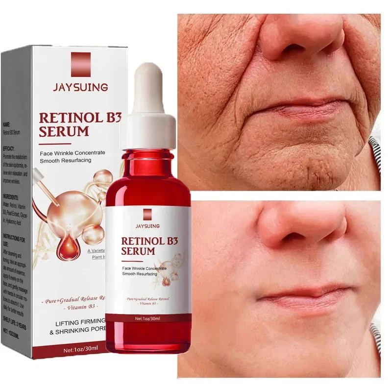 Retinol Face Serum Pure with Vitamin B3 Anti-Aging for Lines Wrinkles Premature Sun Damage Remove Dark Spot