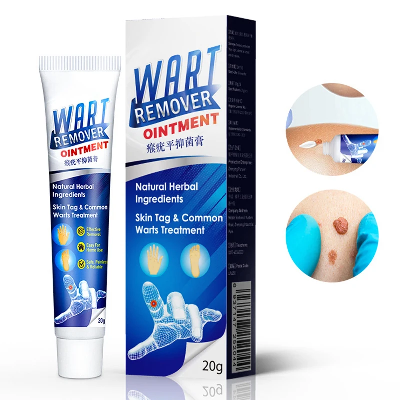 20g Warts Remover Plantar Ointment Wart Treatment Cream Skin Tag