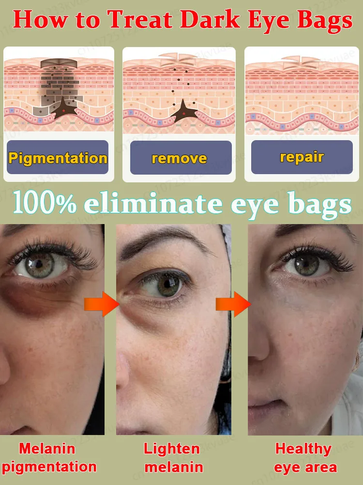 Eye Bag Killer Eliminates 99.9% of eye bags with centella asiatica and aloevera extracts to improve the skin around the eyes