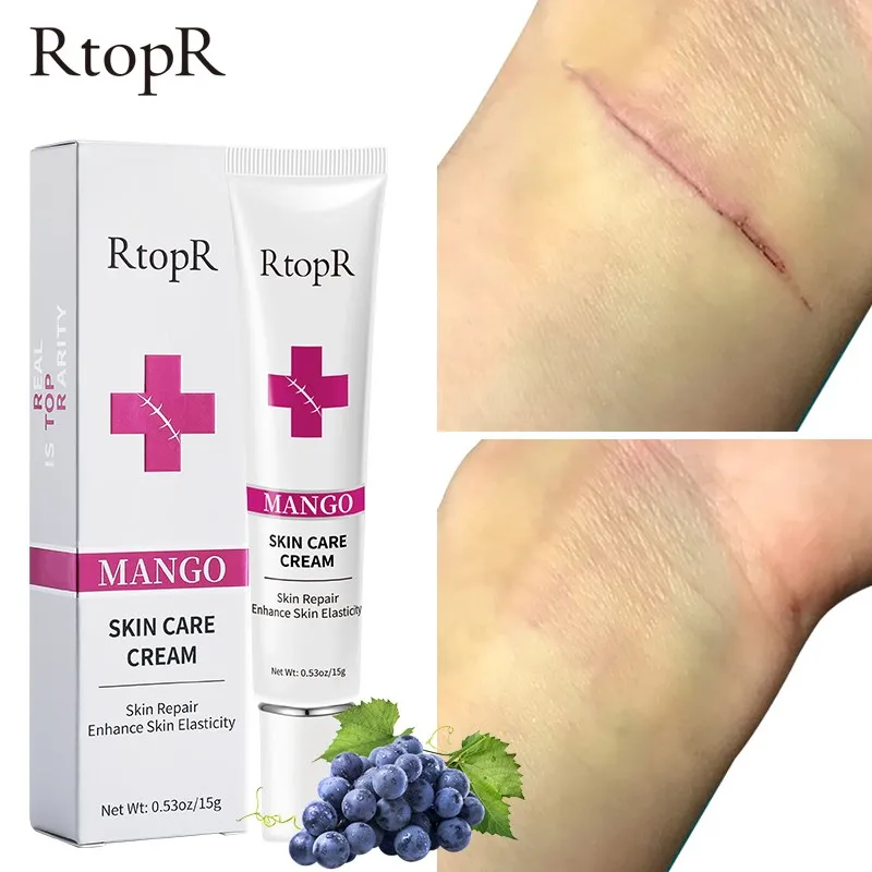 RtopR Scar Cream Gently Removes Scars Repairs Skin Rejuvenates Whitens