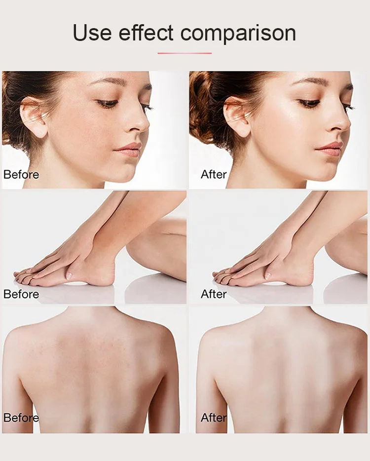 Рисунок 4 - Скребок для кофе MOOYAM