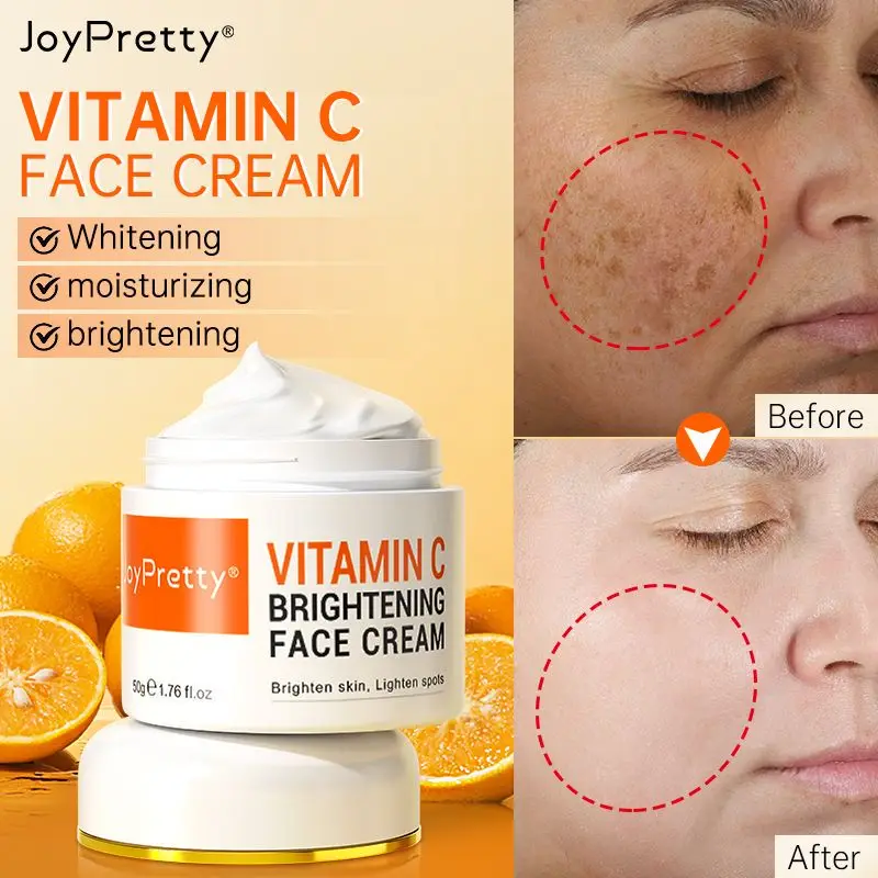 

Vitamin C for Face Cream Pigments Dark Spots Removal Whitening Facial Cream Lightening Skin Care Products Beauty Health