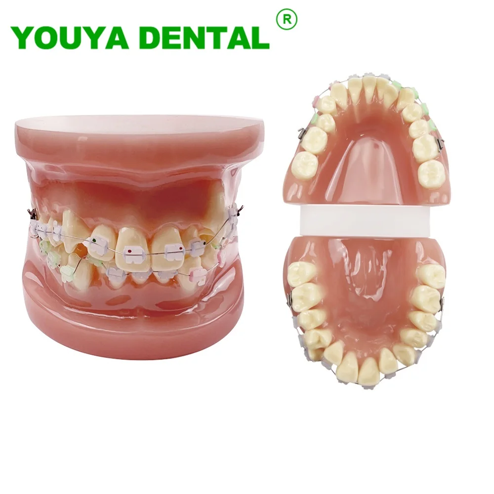 Dental Models For Patient Education Orthodontic Treatment Teeth Model