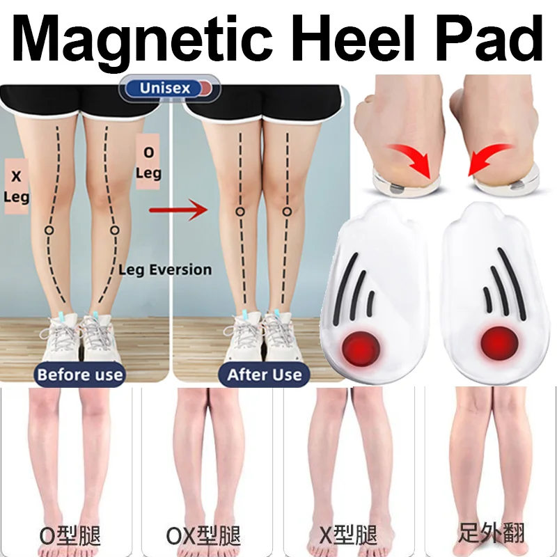 Silicone Orthopedic Insoles for Feet O/x Leg Type Valgus Varus Correction Plantar Fasciitis Gel Insole Magnet Massage Foot Care