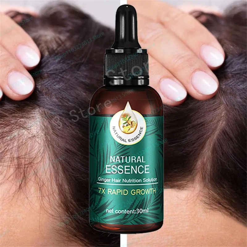 

7 Days Fast Hair Growth Ginger Growth Hair Oil Treatment Anti Hair Loss Men Women Scalp Treatment Serum Products Beauty Health